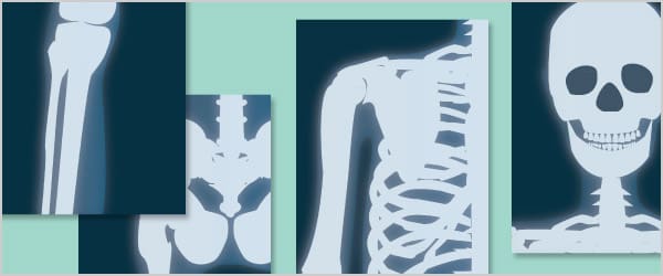 Illustrated X-Ray Posters